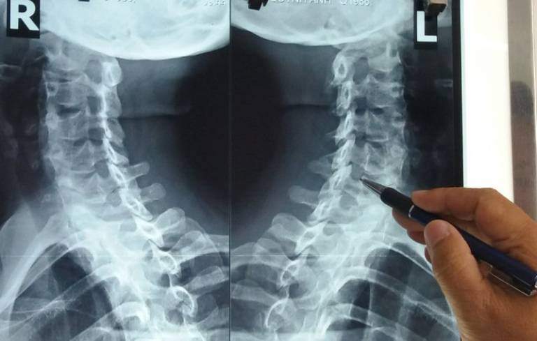 Bộ KH&CN ban hành quy chuẩn kỹ thuật quốc gia đối với thiết bị X-quang đo mật độ xương dùng trong...
